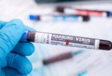 الصحة تكشف حقيقة انتشار فيروس ماربوج فى مصر تحيا مصر