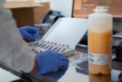 إنجاز عالمي مصر سادس دولة تحقق الاكتفاء الذاتي من مشتقات البلازما