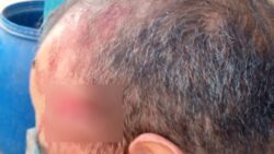 شقيق طالبة يعتدى على مدرس بمقص داخل مدرسة بنات بالإسماعيلية