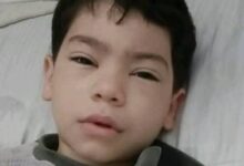 خروج طفل باسوس من غرفة العمليات