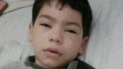 تطورات الحالة الصحية لطفل باسوس المصاب بطلق خرطوش في القليوبية 