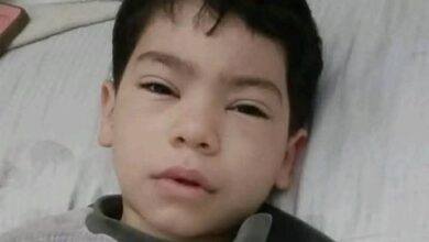 تطورات الحالة الصحية لطفل باسوس المصاب بطلق خرطوش في القليوبية 