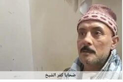 كفر الشيخ :بتر إصبع زوجة وإصابات خطيرة لأسرة كاملة